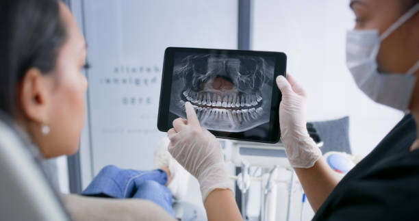 Licensed Teeth Cleaning And Checkup service in Clinton, IL - Smile Center Dentistry